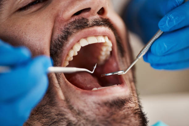 Best Dental Abscess Treatment in Country Club Hls, IL