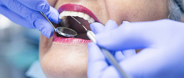 Best Emergency Cosmetic Dentistry (e.g., broken veneers) in Country Club Hls, IL