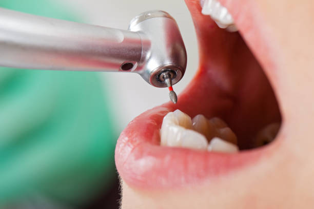 Best Emergency Root Canal Therapy in Country Club Hls, IL